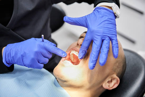 Best Emergency Root Canal Treatment in Dale, IN