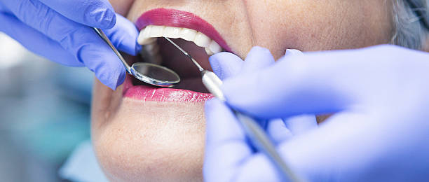 Best Emergency Dentist for Knocked-Out Tooth in Dale, IN